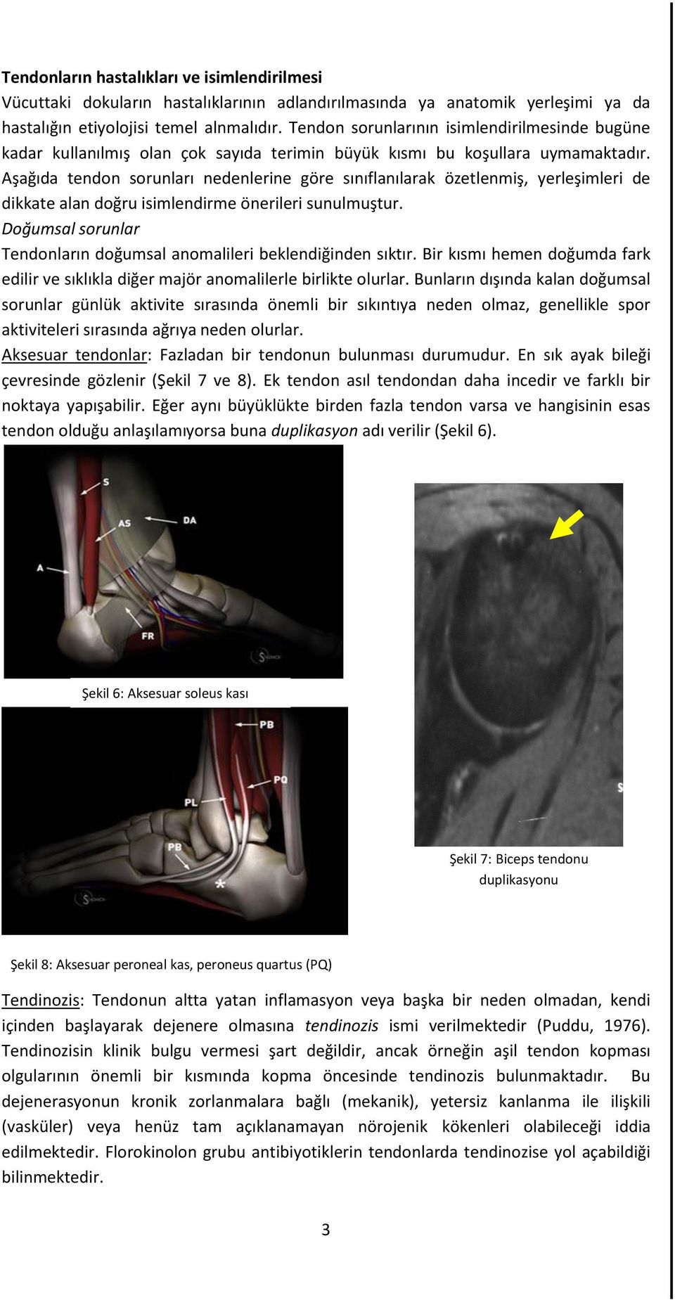 Aşağıda tendon sorunları nedenlerine göre sınıflanılarak özetlenmiş, yerleşimleri de dikkate alan doğru isimlendirme önerileri sunulmuştur.