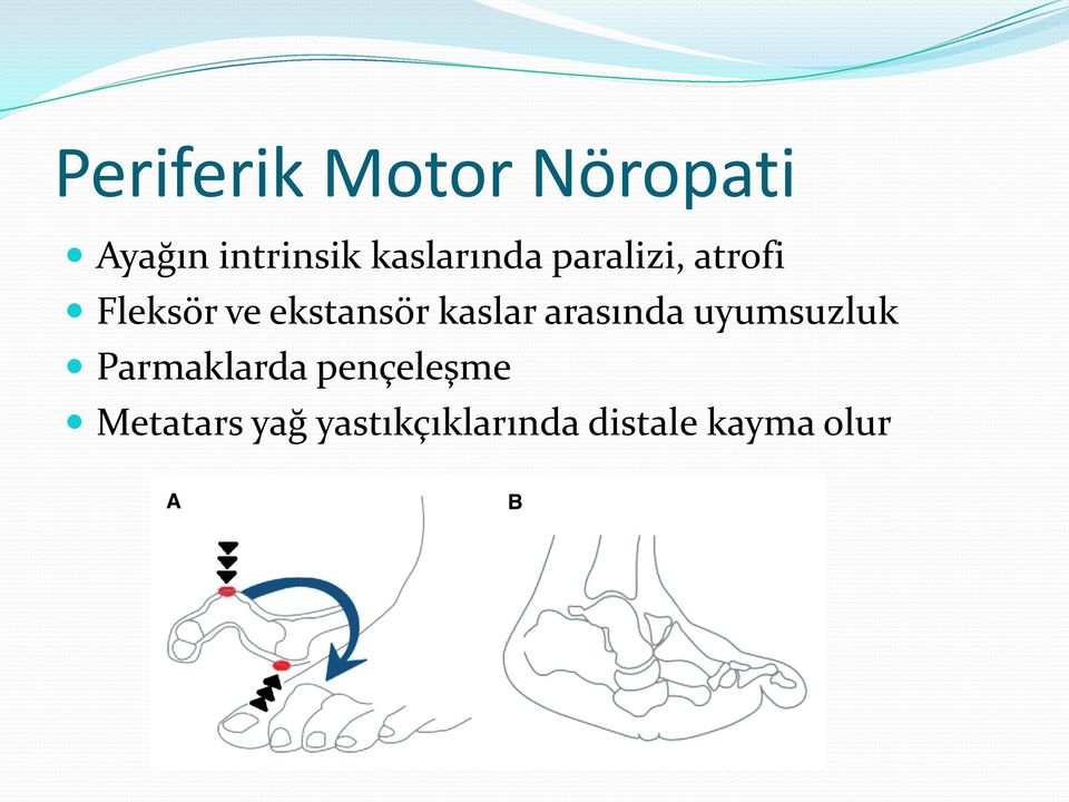 ekstansör kaslar arasında uyumsuzluk