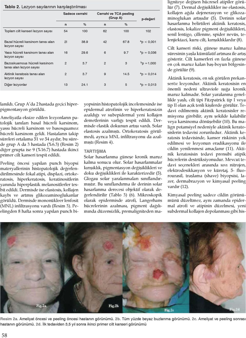 sayısı Yassı hücreli karsinom tanısı alan lezyon sayısı Bazoskuamous hücreli karsinom tanısı alan lezyon sayısı Aktinik keratosis tanısı alan lezyon sayısı lanıldı.