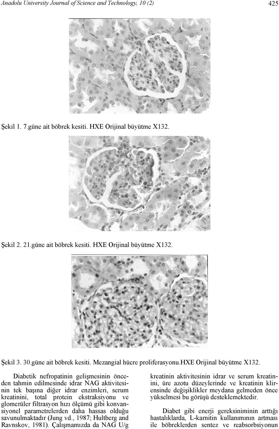 Diabetik nefropatinin gelişmesinin önceden tahmin edilmesinde idrar NAG aktivitesinin tek başına diğer idrar enzimleri, serum kreatinini, total protein ekstraksiyonu ve glomerüler filtrasyon hızı