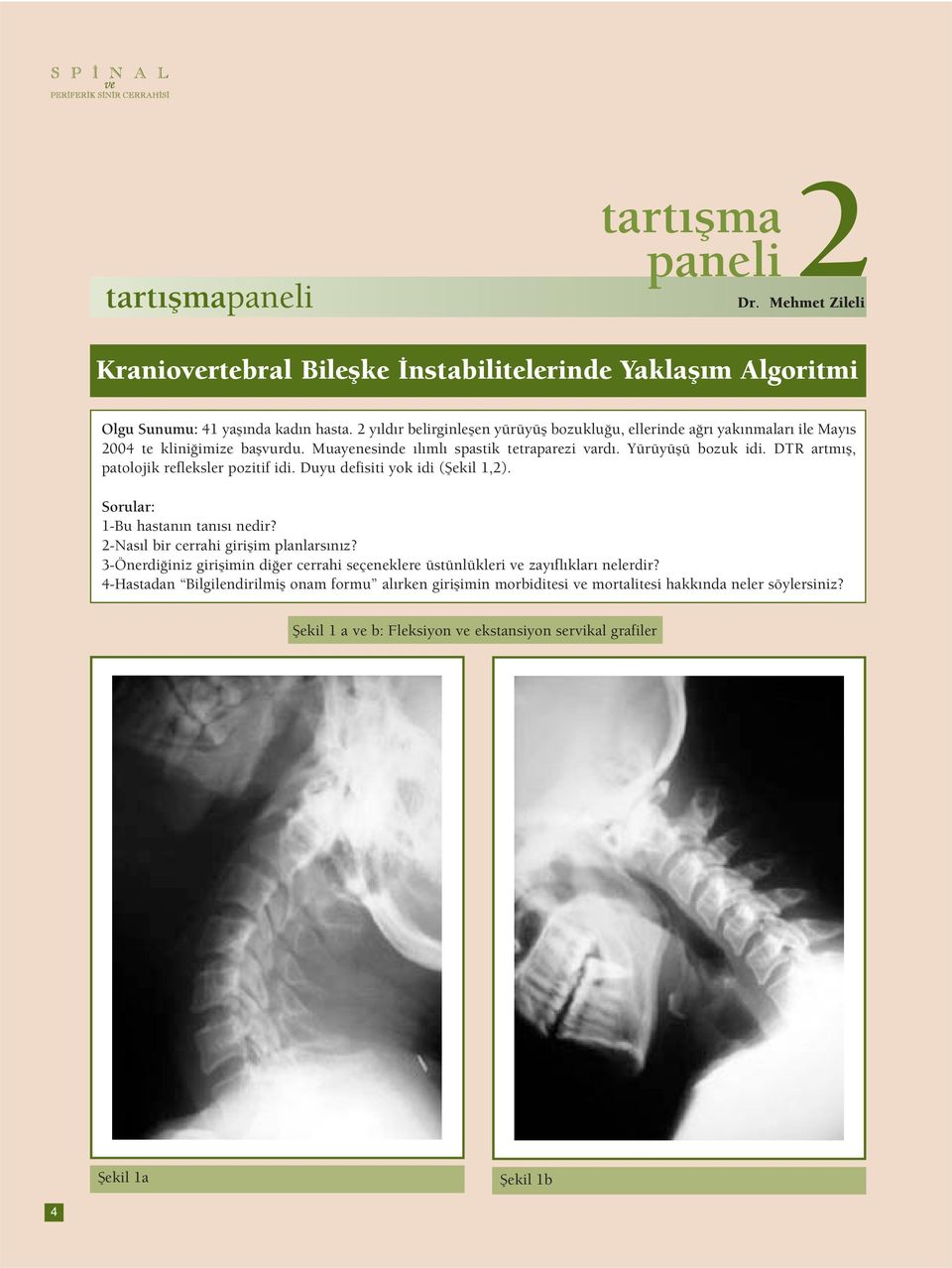 DTR artmış, patolojik refleksler pozitif idi. Duyu defisiti yok idi (Şekil 1,2). Sorular: 1-Bu hastanın tanısı nedir? 2-Nasıl bir cerrahi girişim planlarsınız?