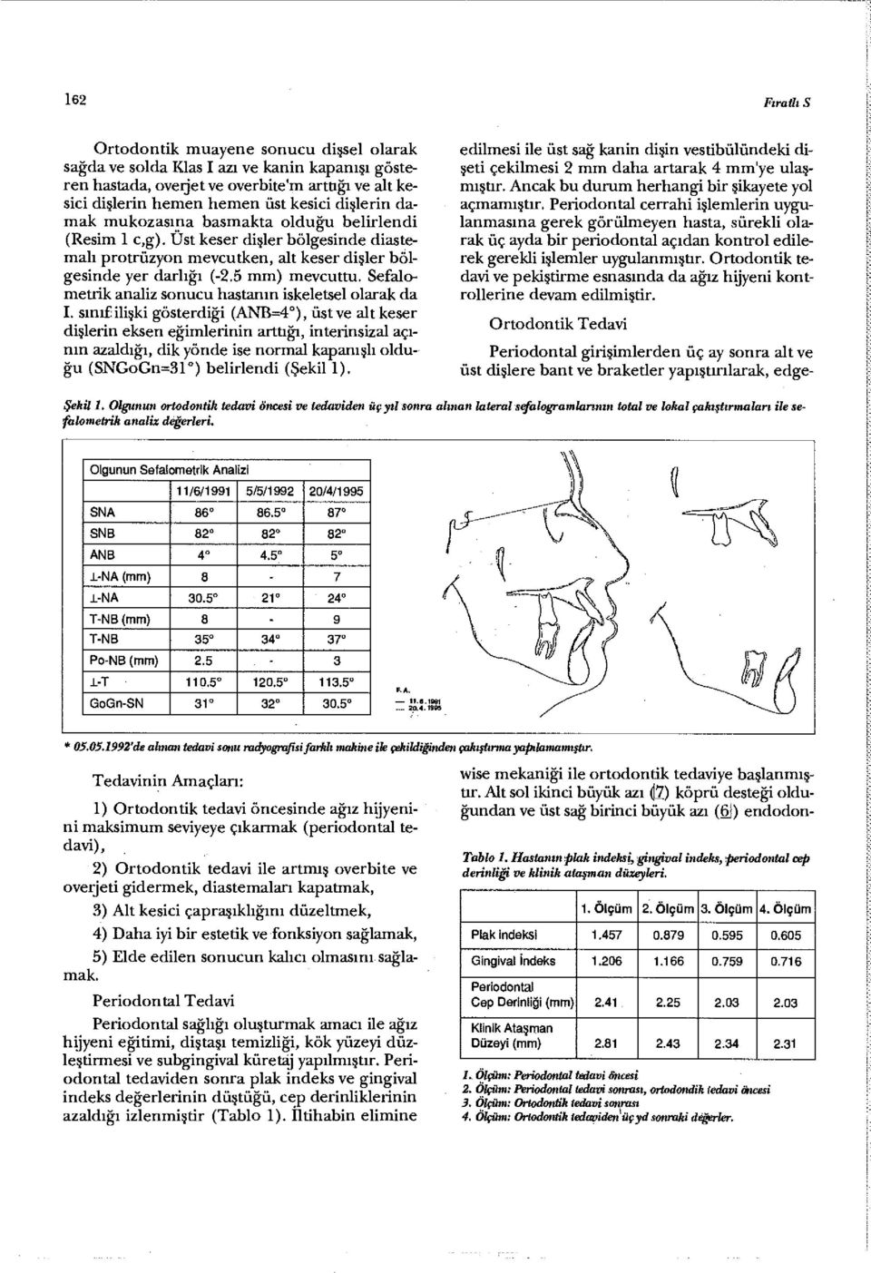 Sefalometrik analiz sonucu hastanın iskeletsel olarak da I.