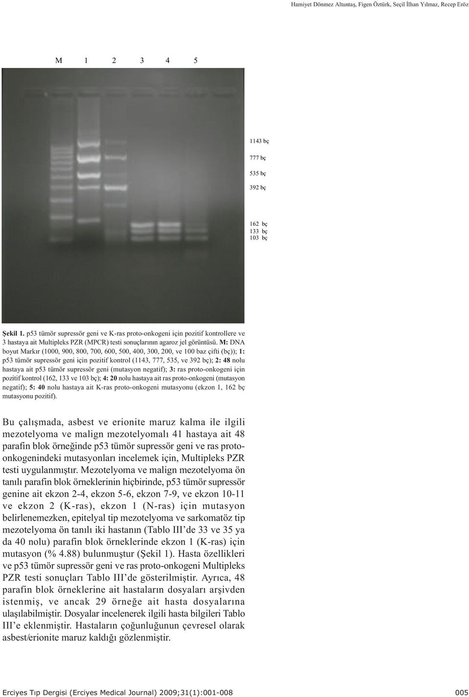 M: DNA boyut Markýr (1000, 900, 800, 700, 600, 500, 400, 300, 200, ve 100 baz çifti (bç)); 1: p53 tümör supressör geni için pozitif kontrol (1143, 777, 535, ve 392 bç); 2: 48 nolu hastaya ait p53