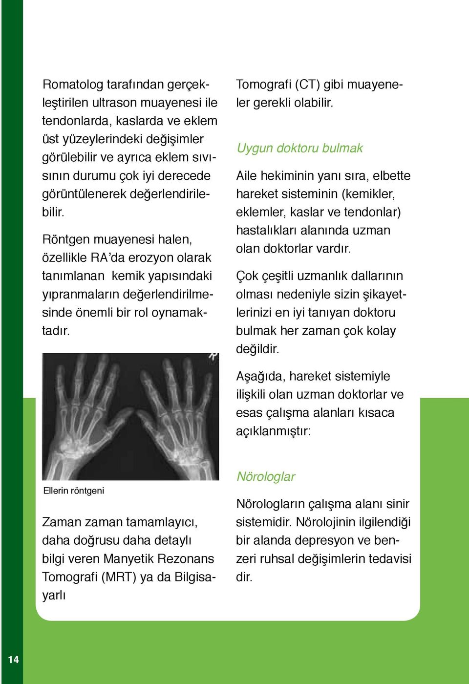 Tomografi (CT) gibi muayeneler gerekli olabilir.