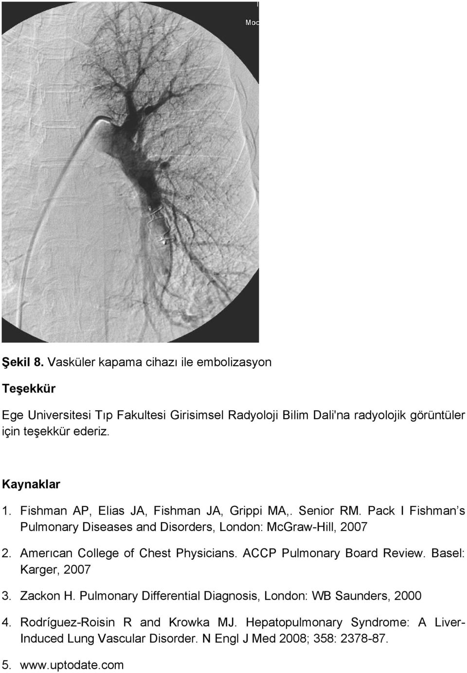 Kaynaklar 1. Fishman AP, Elias JA, Fishman JA, Grippi MA,. Senior RM. Pack I Fishman s Pulmonary Diseases and Disorders, London: McGraw-Hill, 2007 2.