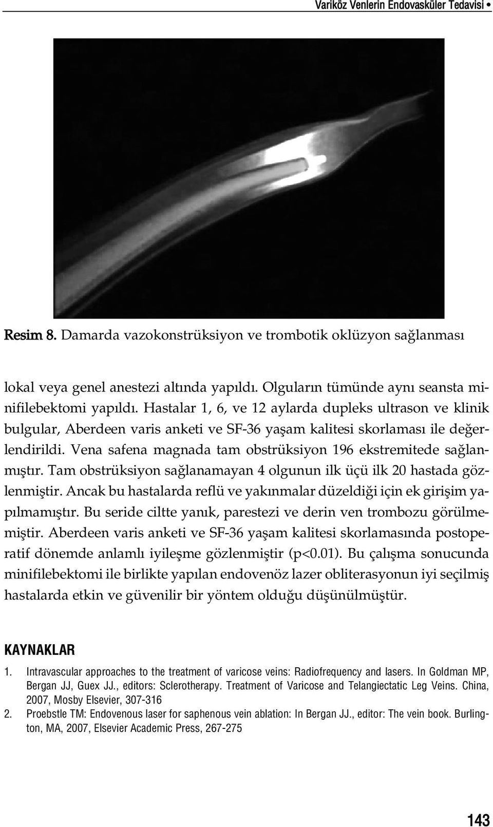 Vena safena magnada tam obstrüksiyon 196 ekstremitede sa lanm flt r. Tam obstrüksiyon sa lanamayan 4 olgunun ilk üçü ilk 20 hastada gözlenmifltir.