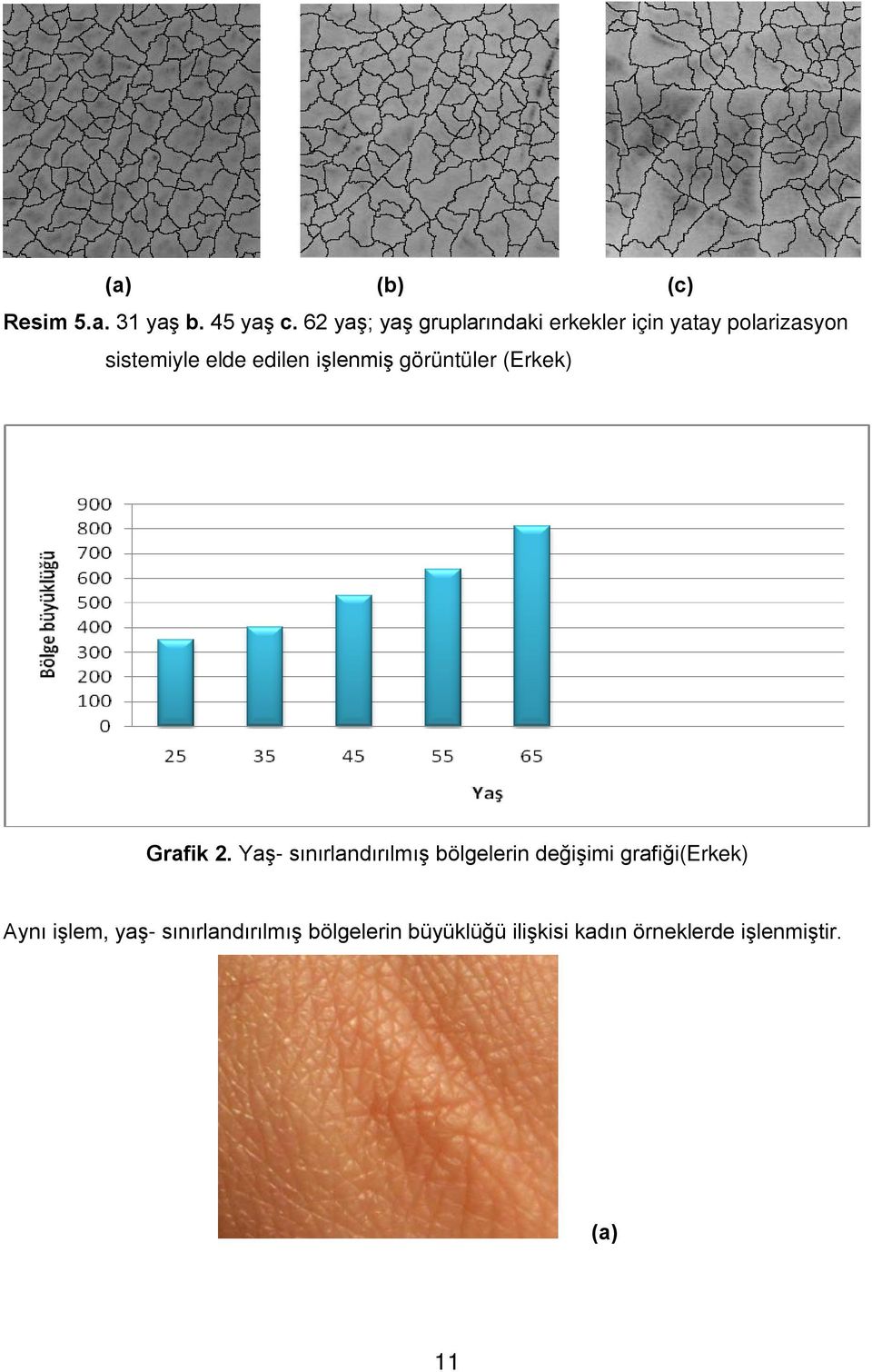 edilen işlenmiş görüntüler (Erkek) Grafik 2.