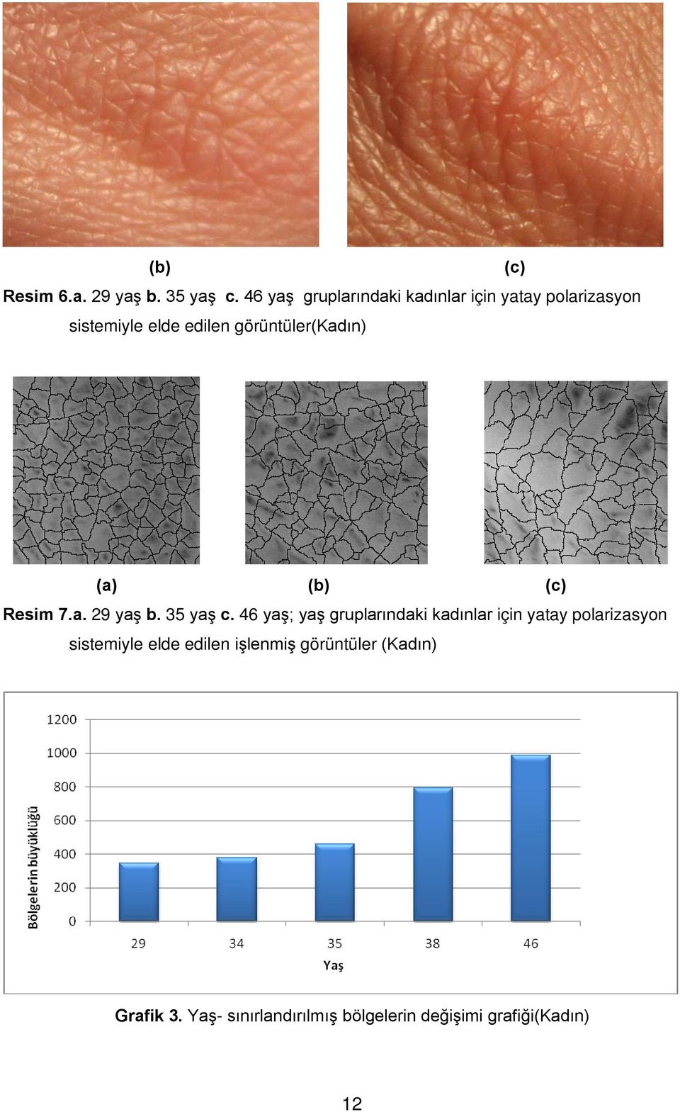 görüntüler(kadın) (a) (b) (c) Resim 7.a. 29 yaş b. 35 yaş c.