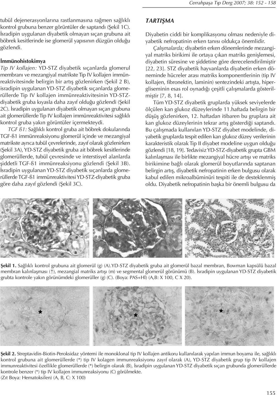 İmmünohistokimya Tip IV kollajen: YD-STZ diyabetik sıçanlarda glomerul membranı ve mezangiyal matrikste Tip IV kollajen immünreaktivitesinde belirgin bir artış gözlenirken (Şekil 2 B), isradipin