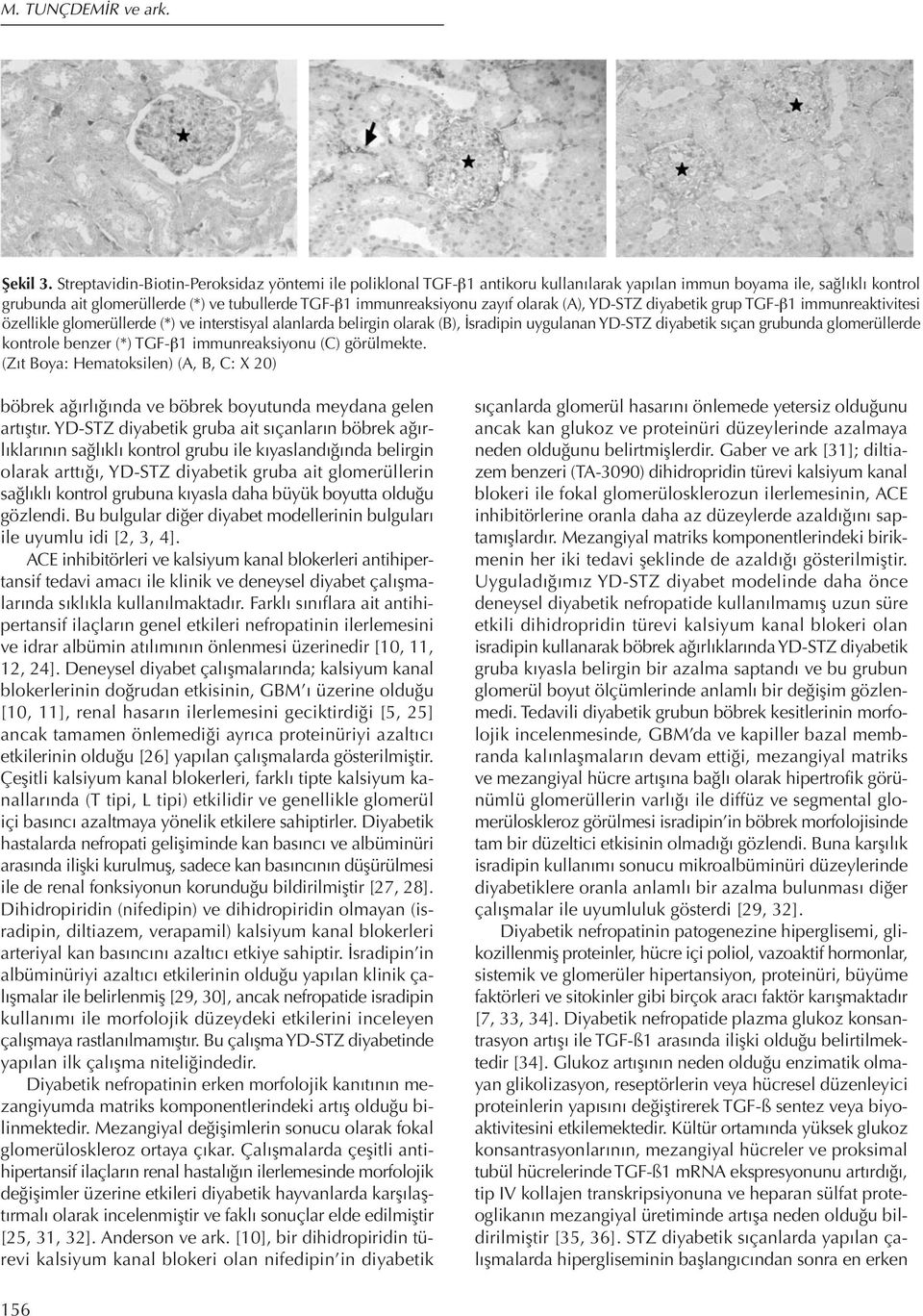 olarak (A), YD-STZ diyabetik grup TGF-β1 immunreaktivitesi özellikle glomerüllerde (*) ve interstisyal alanlarda belirgin olarak (B), İsradipin uygulanan YD-STZ diyabetik sıçan grubunda glomerüllerde