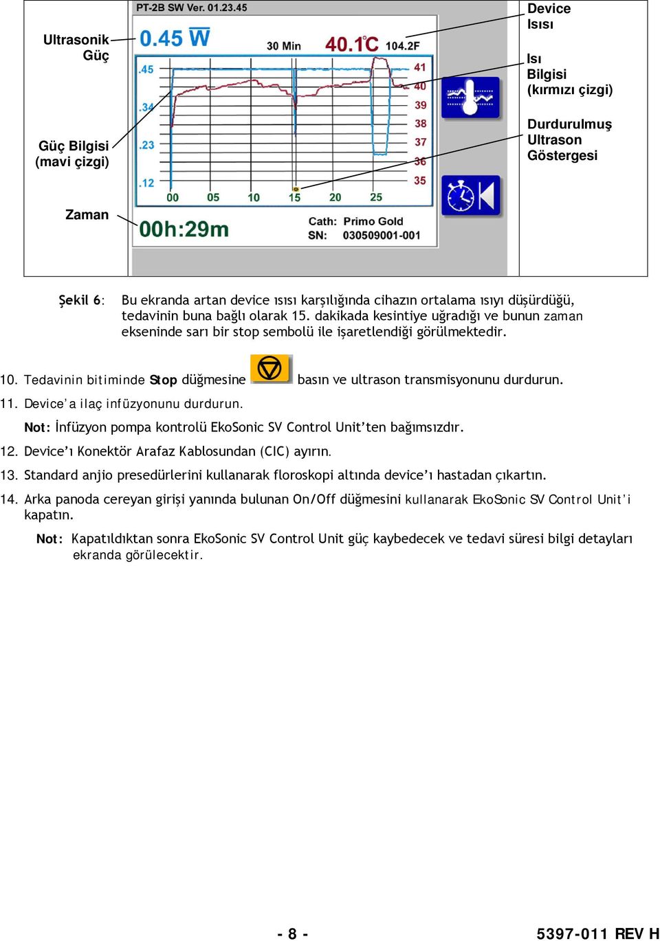 Tedavinin bitiminde Stop düğmesine basın ve ultrason transmisyonunu durdurun. 11. Device a ilaç infüzyonunu durdurun. Not: İnfüzyon pompa kontrolü EkoSonic SV Control Unit ten bağımsızdır. 12.