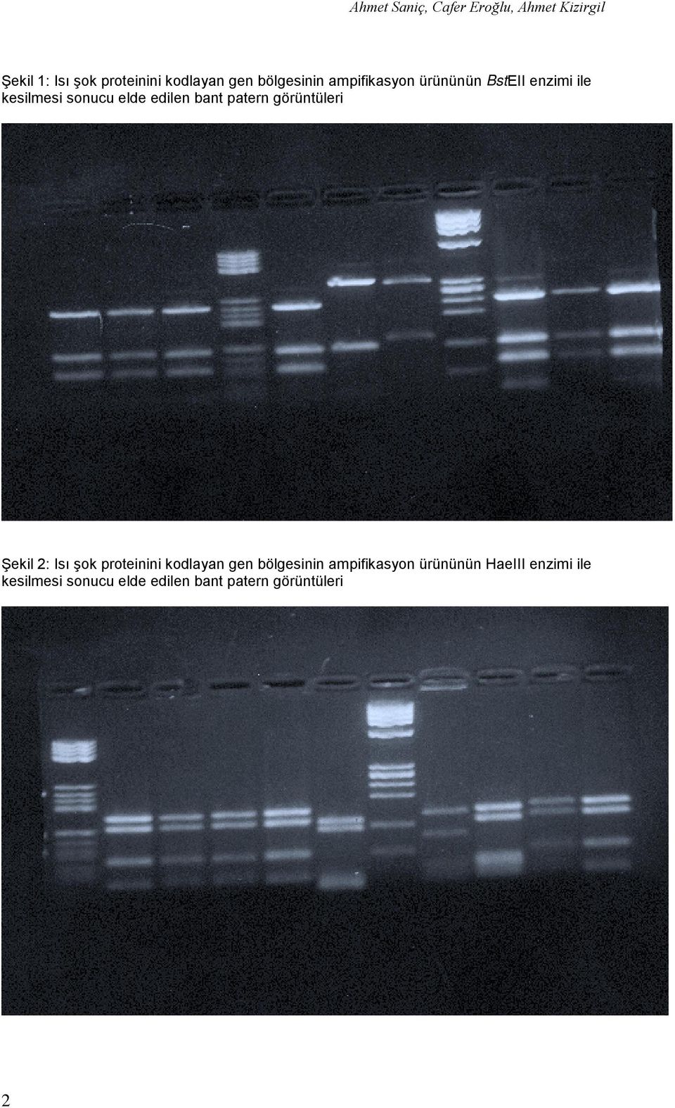 bant patern görüntüleri Şekil 2: Isı şok proteinini kodlayan gen bölgesinin