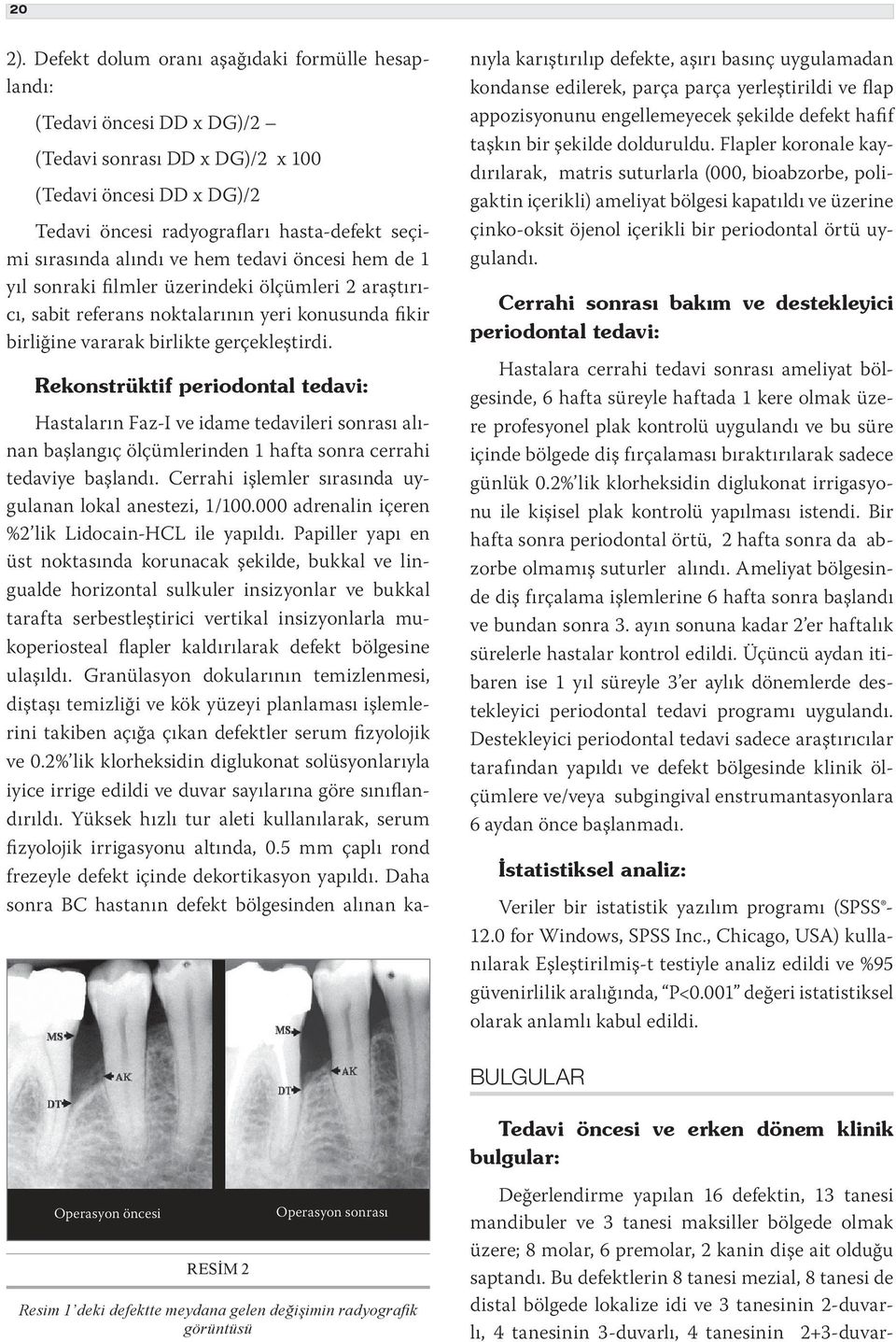 ve hem tedavi öncesi hem de 1 yıl sonraki filmler üzerindeki ölçümleri 2 araştırıcı, sabit referans noktalarının yeri konusunda fikir birliğine vararak birlikte gerçekleştirdi.