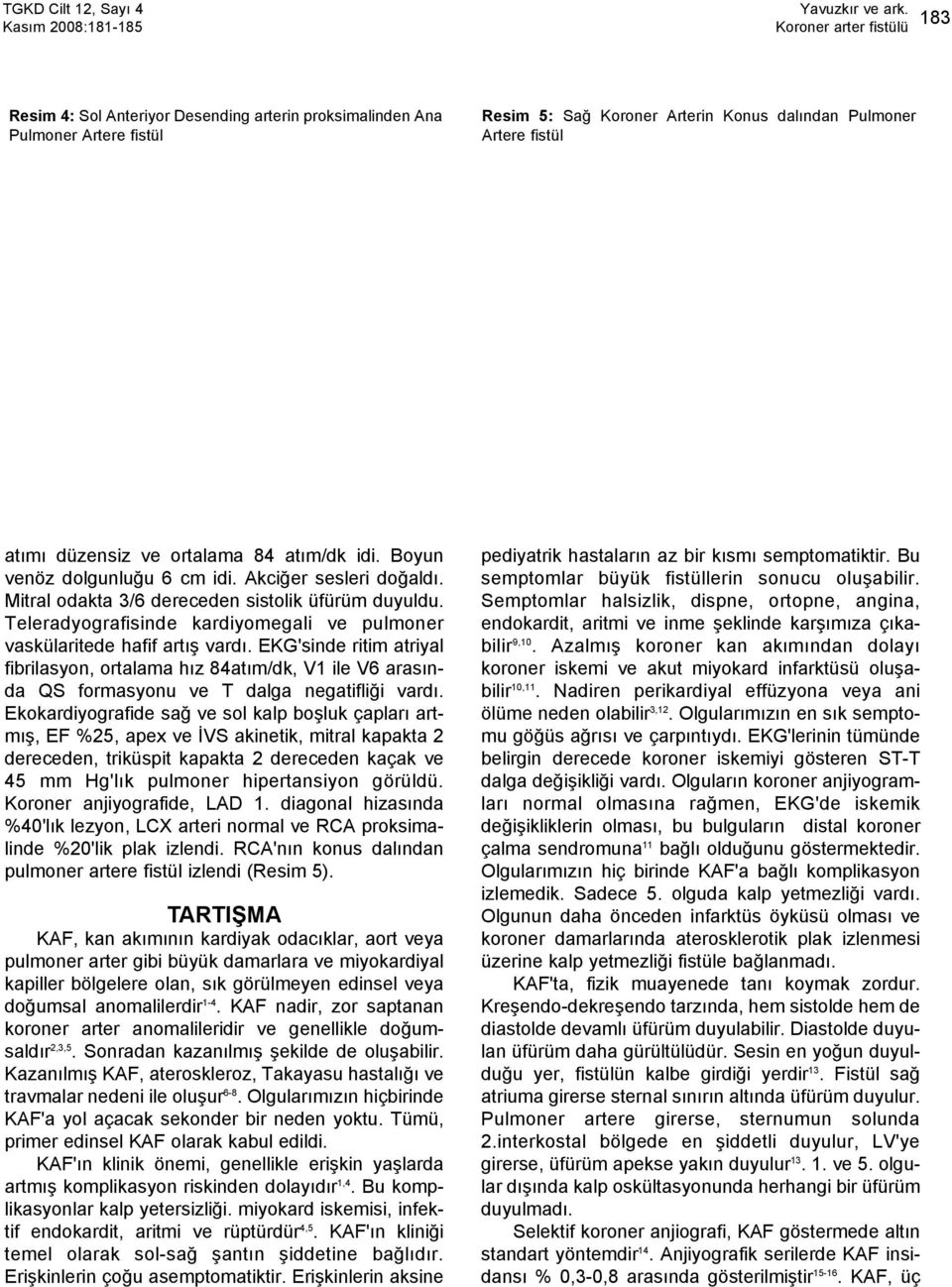 EKG'sinde ritim atriyal fibrilasyon, ortalama hız 84atım/dk, V1 ile V6 arasında QS formasyonu ve T dalga negatifliği vardı.