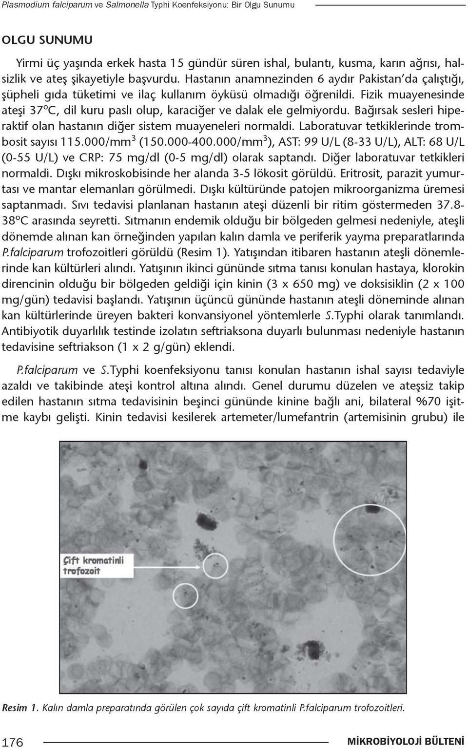 Fizik muayenesinde ateşi 37 o C, dil kuru paslı olup, karaciğer ve dalak ele gelmiyordu. Bağırsak sesleri hiperaktif olan hastanın diğer sistem muayeneleri normaldi.