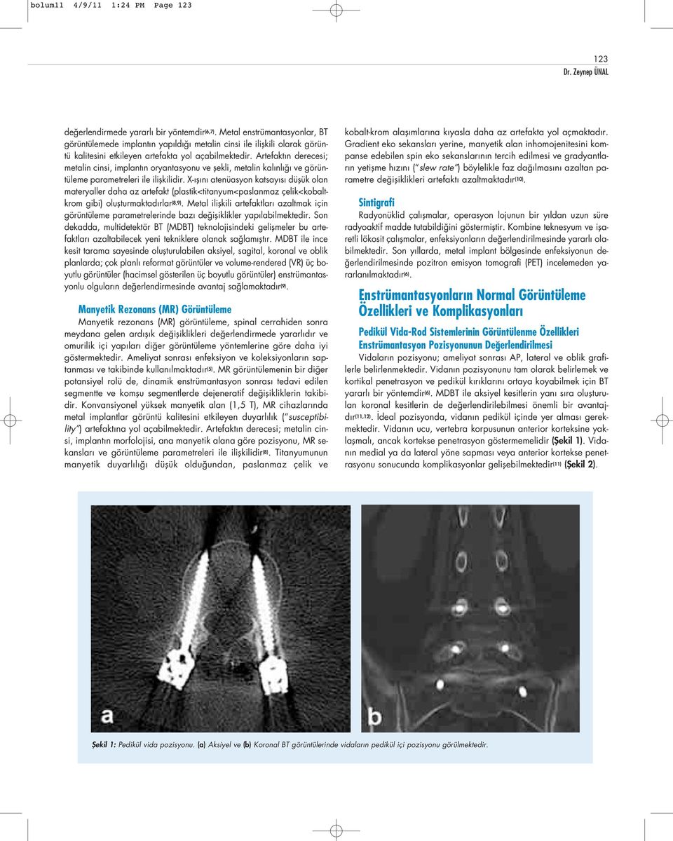 Artefakt n derecesi; metalin cinsi, implant n oryantasyonu ve flekli, metalin kal nl ve görüntüleme parametreleri ile iliflkilidir.