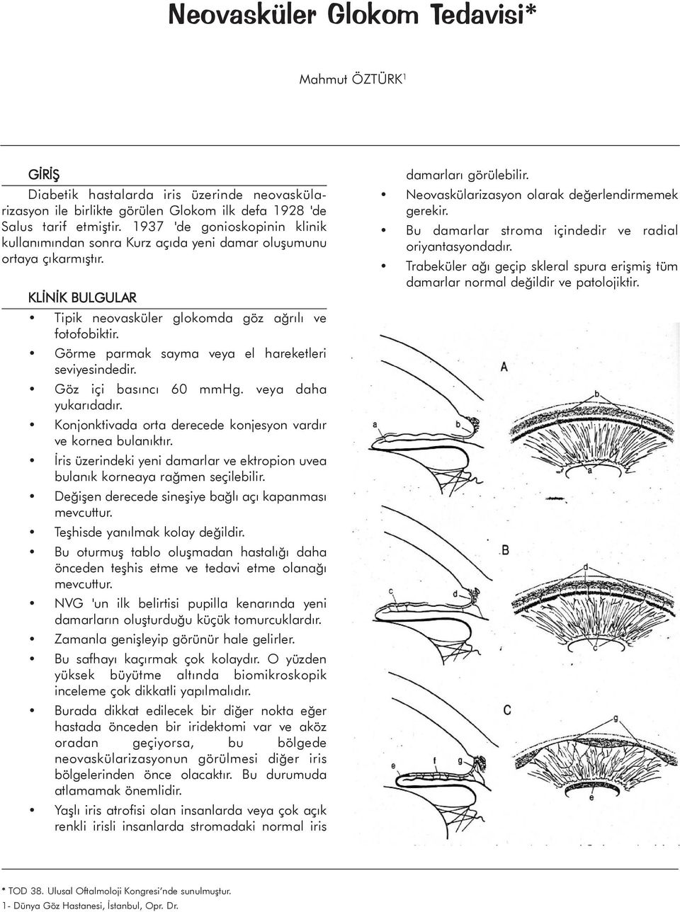 Görme parmak sayma veya el hareketleri seviyesindedir. Göz içi basýncý 60 mmhg. veya daha yukarýdadýr. Konjonktivada orta derecede konjesyon vardýr ve kornea bulanýktýr.