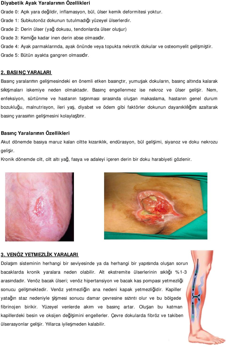 Grade 4: Ayak parmaklar nda, ayak önünde veya topukta nekrotik dokular ve osteomyelit geli mi tir. Grade 5: Bütün ayakta gangren olmas r. 2.