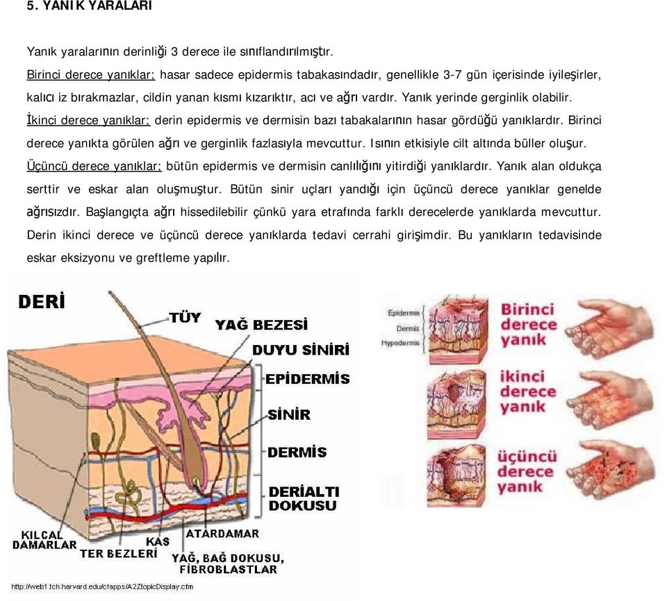 Yan k yerinde gerginlik olabilir. kinci derece yan klar; derin epidermis ve dermisin baz tabakalar n hasar gördü ü yan klard r. Birinci derece yan kta görülen a ve gerginlik fazlas yla mevcuttur.