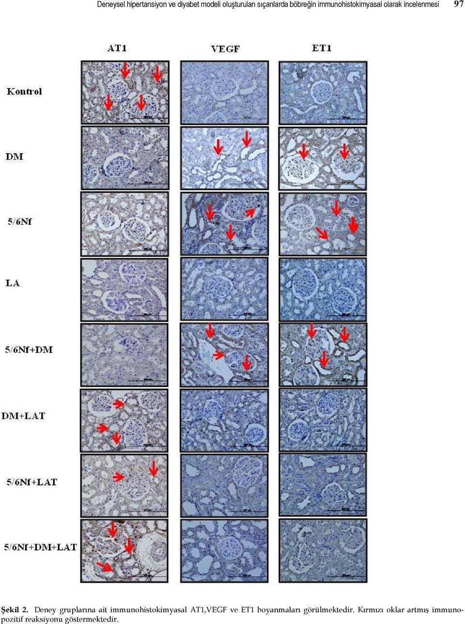 Deney gruplarına ait immunohistokimyasal AT1,VEGF ve ET1