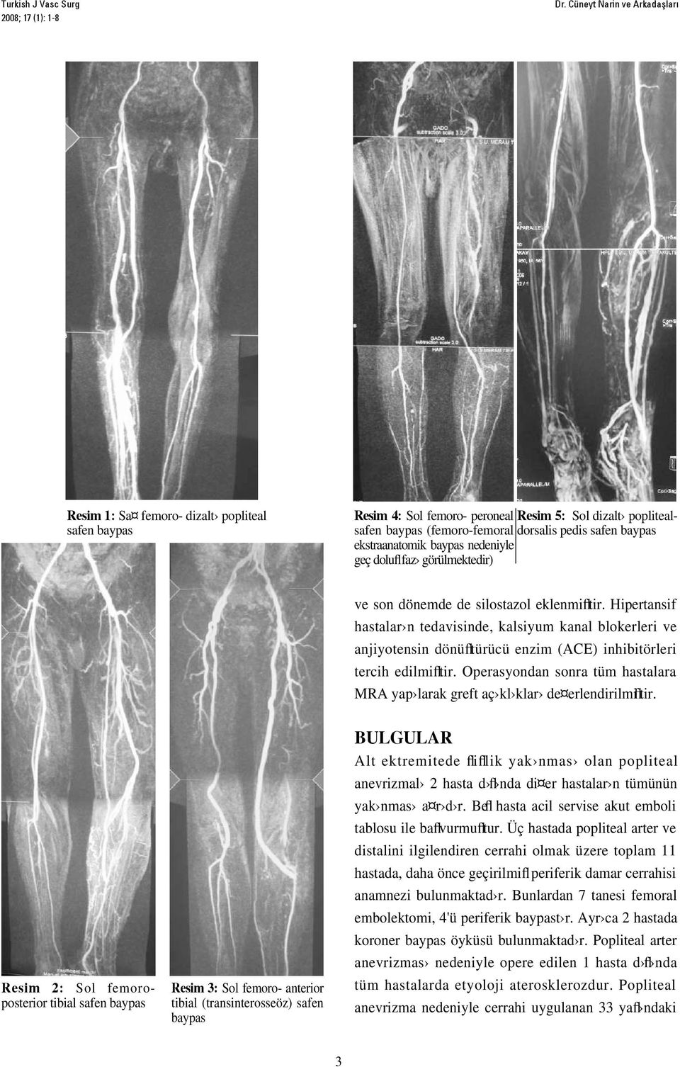 ekstraanatomik baypas nedeniyle geç dolufl faz görülmektedir) ve son dönemde de silostazol eklenmifltir.