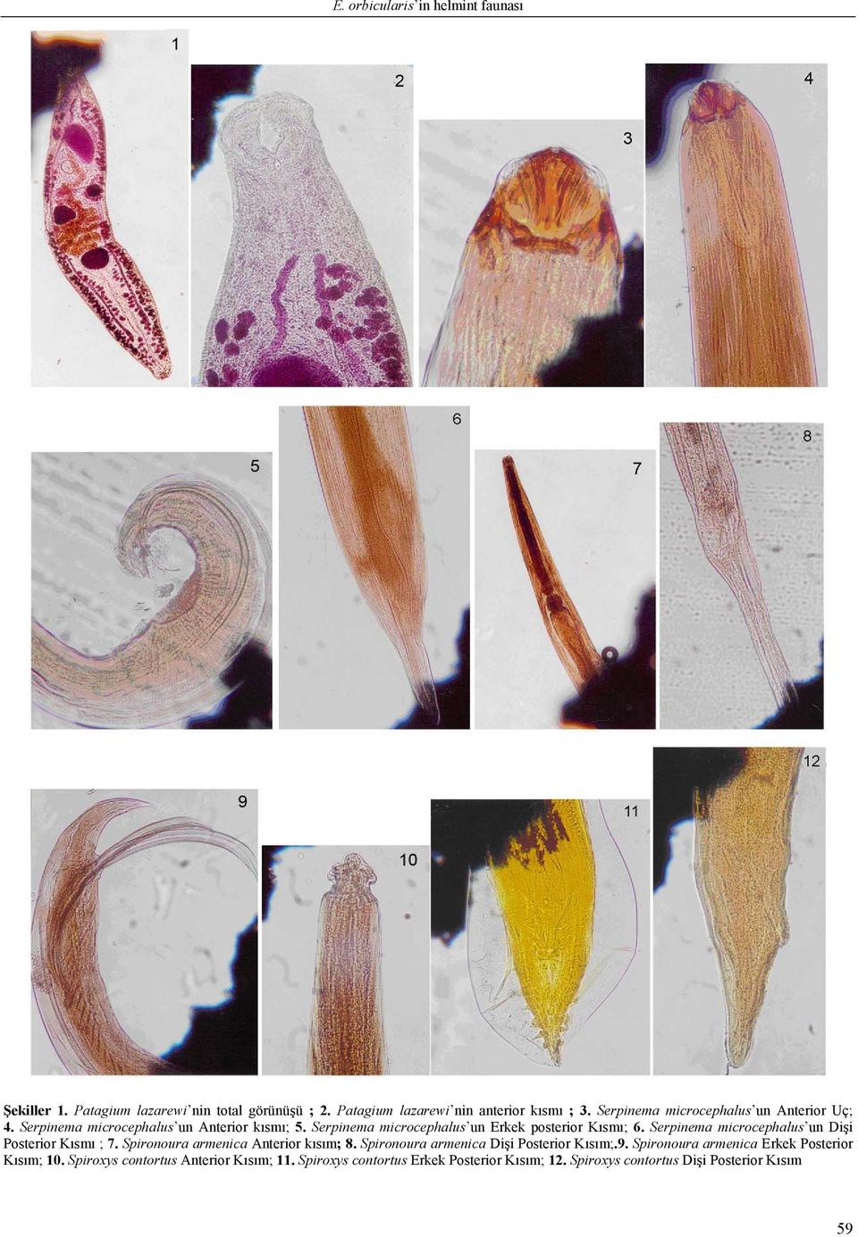 Serpinema microcephalus un Dişi Posterior Kısmı ; 7. Spironoura armenica Anterior kısım; 8. Spironoura armenica Dişi Posterior Kısım;.9.