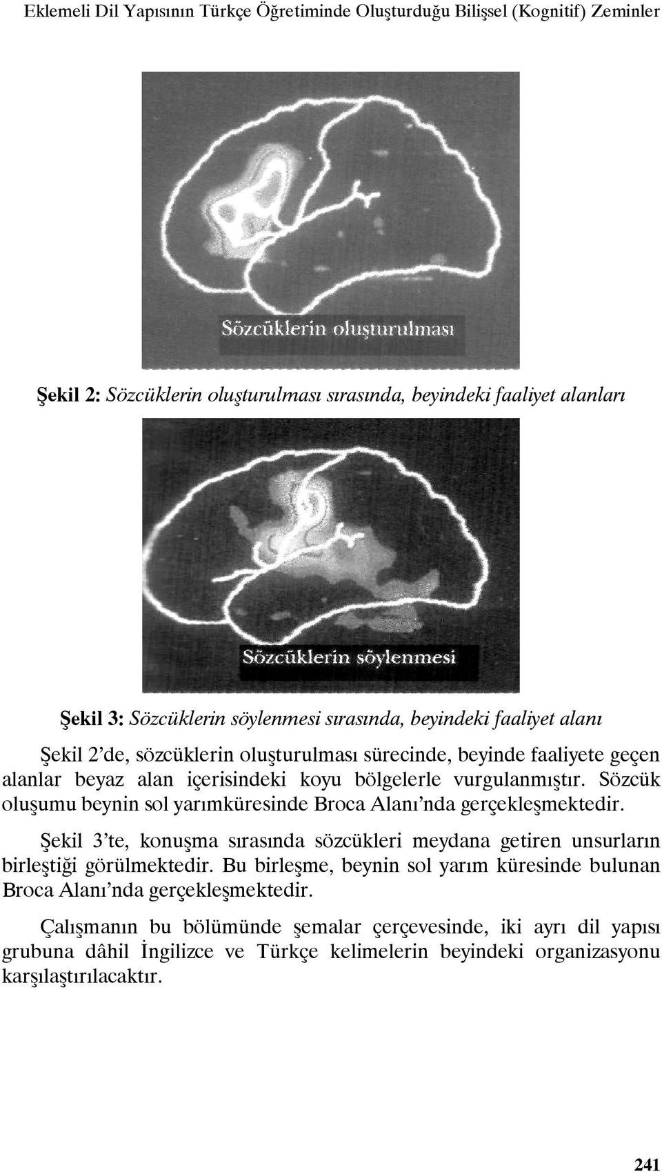 Sözcük oluşumu beynin sol yarımküresinde Broca Alanı nda gerçekleşmektedir. Şekil 3 te, konuşma sırasında sözcükleri meydana getiren unsurların birleştiği görülmektedir.