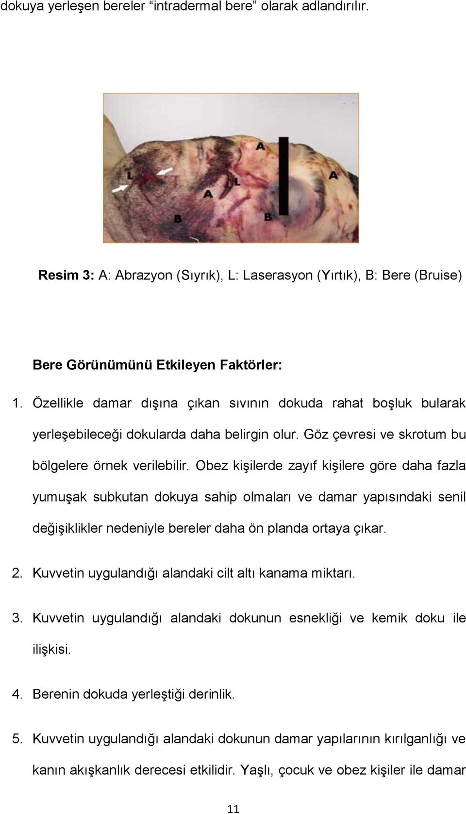 Obez kişilerde zayıf kişilere göre daha fazla yumuşak subkutan dokuya sahip olmaları ve damar yapısındaki senil değişiklikler nedeniyle bereler daha ön planda ortaya çıkar. 2.