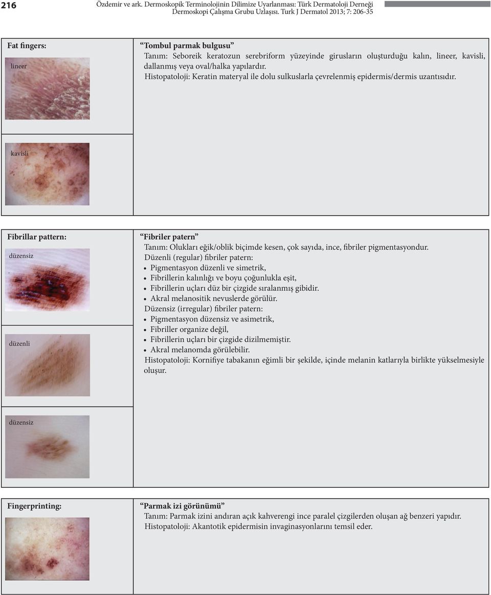 lineer, kavisli, dallanmış veya oval/halka yapılardır. Histopatoloji: Keratin materyal ile dolu sulkuslarla çevrelenmiş epidermis/dermis uzantısıdır.