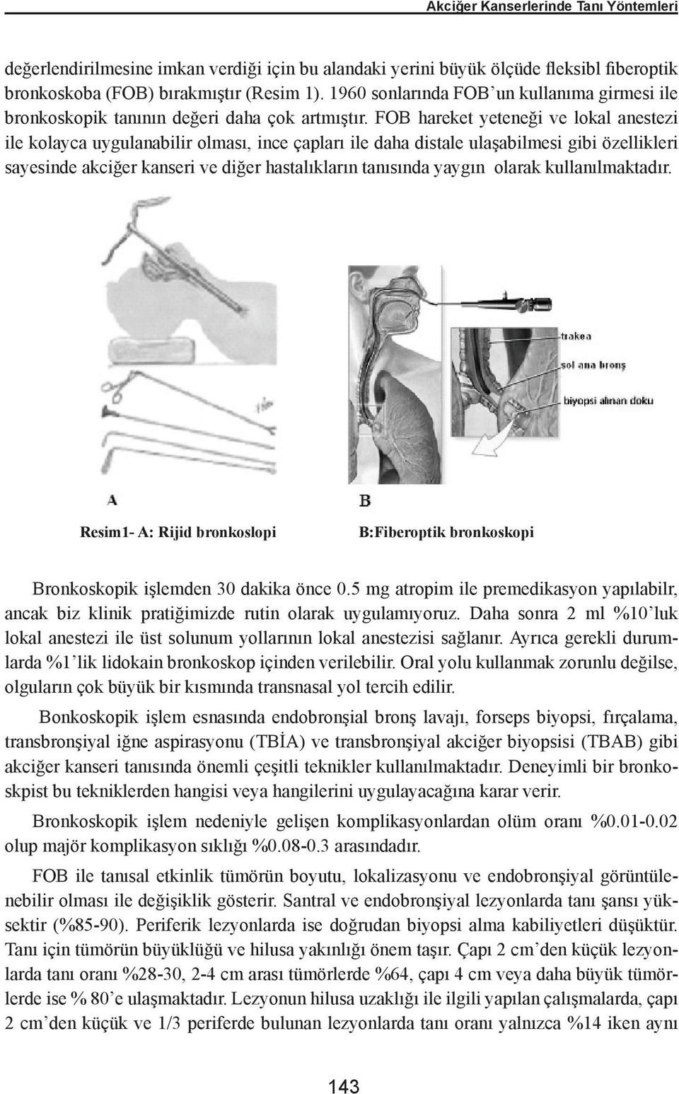 FOB hareket yeteneği ve lokal anestezi ile kolayca uygulanabilir olması, ince çapları ile daha distale ulaşabilmesi gibi özellikleri sayesinde akciğer kanseri ve diğer hastalıkların tanısında yaygın