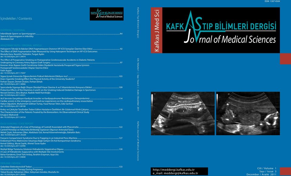 .. 92 The Effect of DNA Fragmantation Rate Measured by Using Halosperm Technique on IVF-ICSI Outcomes Mustafa Kara, Nurettin Türktekin, Turgut Aydın doi: 10.5505/kjms.2011.