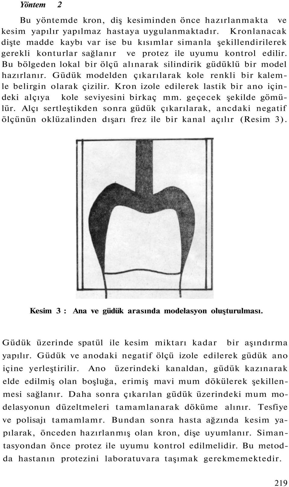 Bu bölgeden lokal bir ölçü alınarak silindirik güdüklü bir model hazırlanır. Güdük modelden çıkarılarak kole renkli bir kalemle belirgin olarak çizilir.