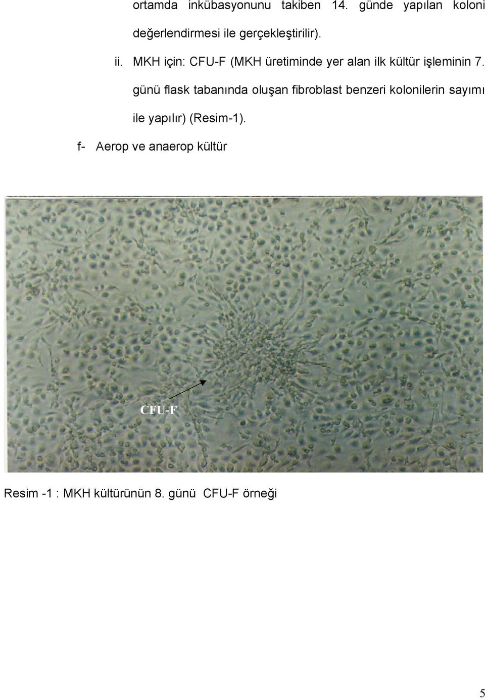 MKH için: CFU-F (MKH üretiminde yer alan ilk kültür işleminin 7.