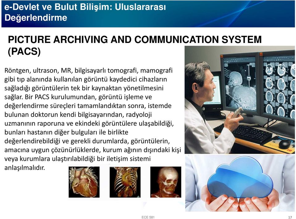 Bir PACS kurulumundan, görüntü işleme ve değerlendirme süreçleri tamamlandıktan sonra, istemde bulunan doktorun kendi bilgisayarından, radyoloji uzmanının raporuna ve