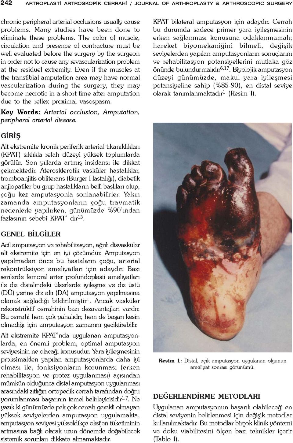 The color of muscle, circulation and presence of contracture must be well evaluated before the surgery by the surgeon in order not to cause any revascularization problem at the residuel extremity.