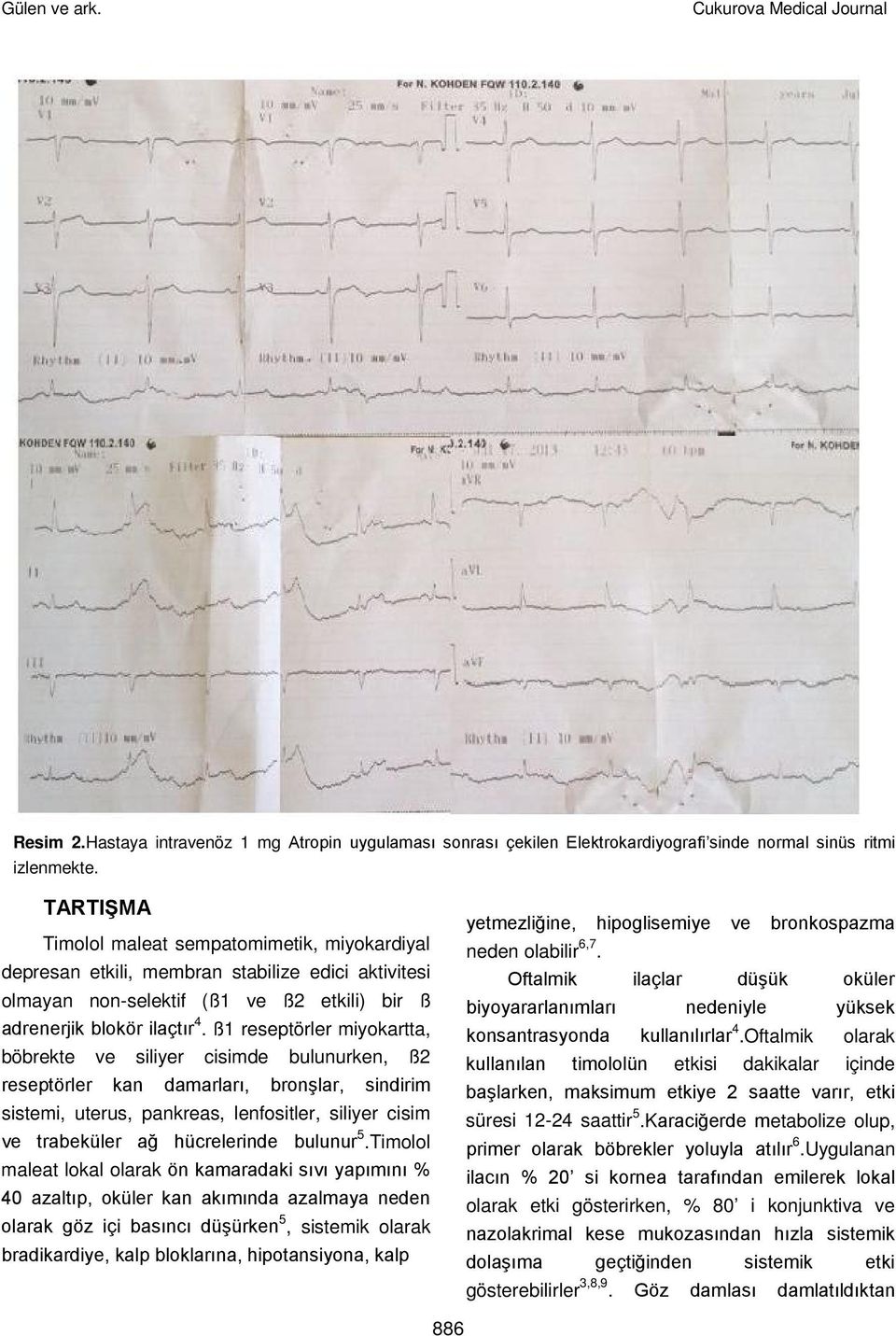 ß1 reseptörler miyokartta, böbrekte ve siliyer cisimde bulunurken, ß2 reseptörler kan damarları, bronşlar, sindirim sistemi, uterus, pankreas, lenfositler, siliyer cisim ve trabeküler ağ hücrelerinde