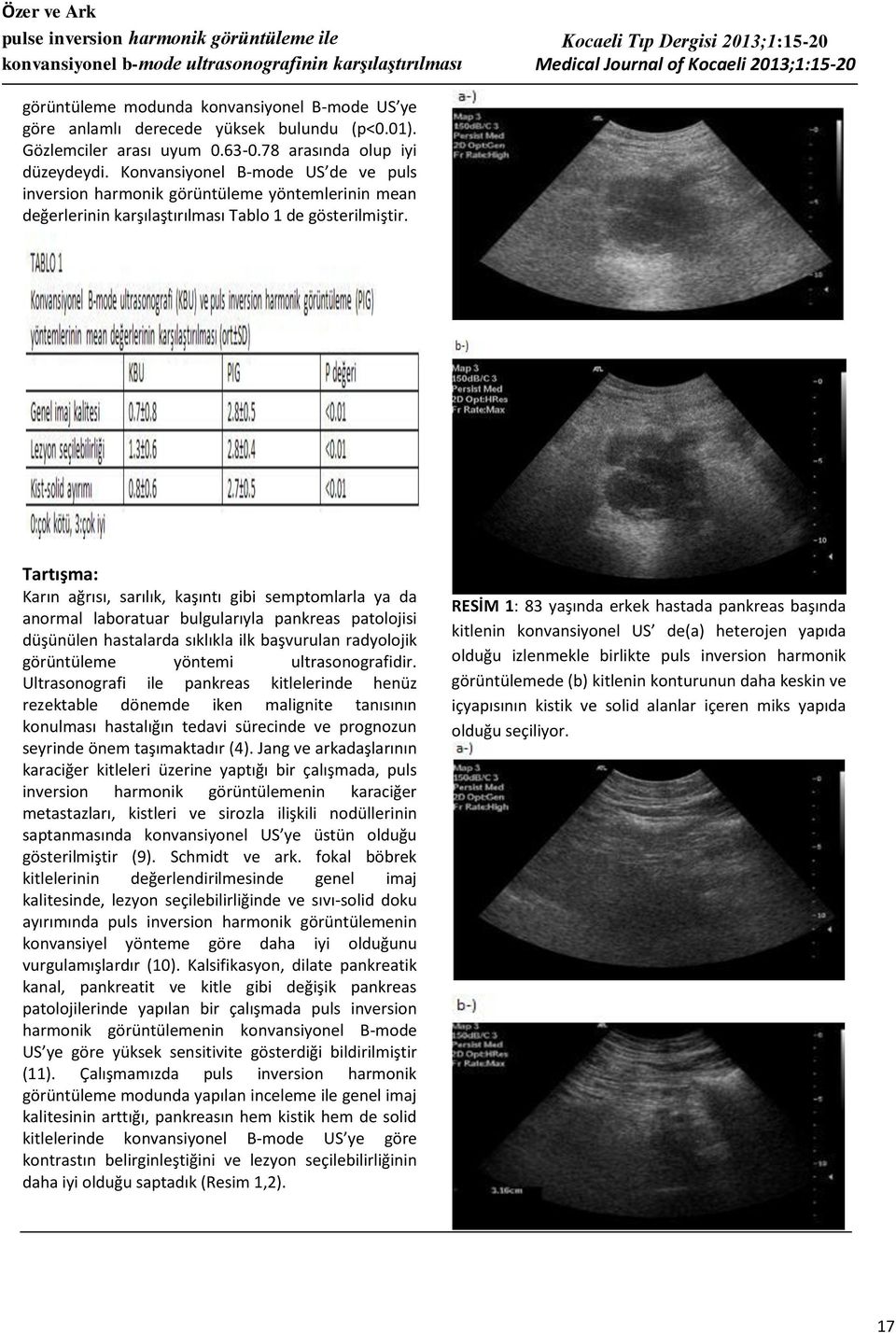 Konvansiyonel B-mode US de ve puls inversion harmonik görüntüleme yöntemlerinin mean değerlerinin karşılaştırılması Tablo 1 de gösterilmiştir.