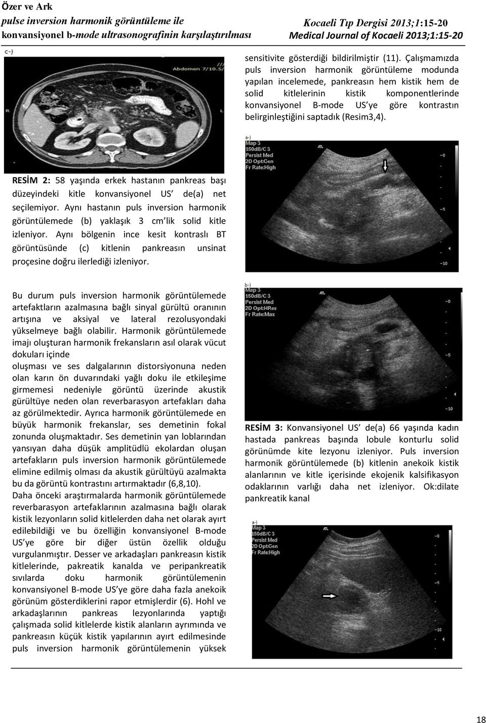 Çalışmamızda puls inversion harmonik görüntüleme modunda yapılan incelemede, pankreasın hem kistik hem de solid kitlelerinin kistik komponentlerinde konvansiyonel B-mode US ye göre kontrastın