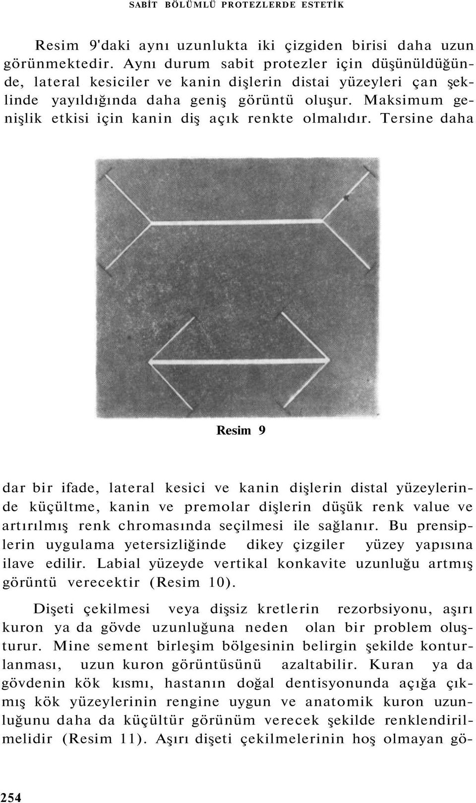 Maksimum genişlik etkisi için kanin diş açık renkte olmalıdır.