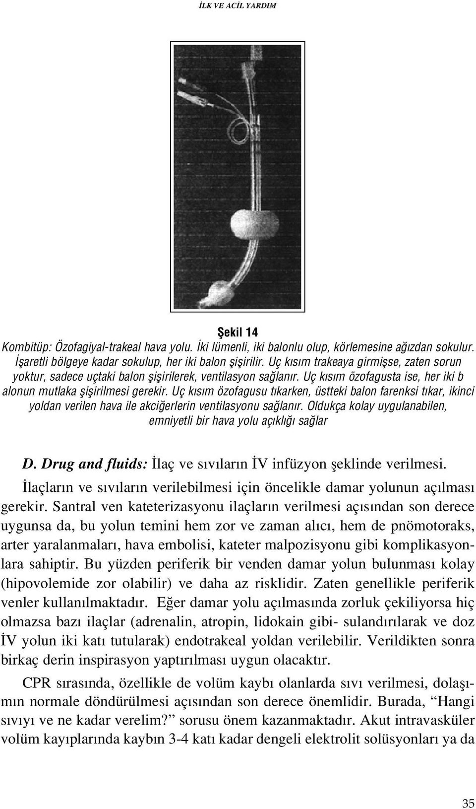 Uç k s m özofagusu t karken, üstteki balon farenksi t kar, ikinci yoldan verilen hava ile akci erlerin ventilasyonu sa lan r. Oldukça kolay uygulanabilen, emniyetli bir hava yolu aç kl sa lar D.