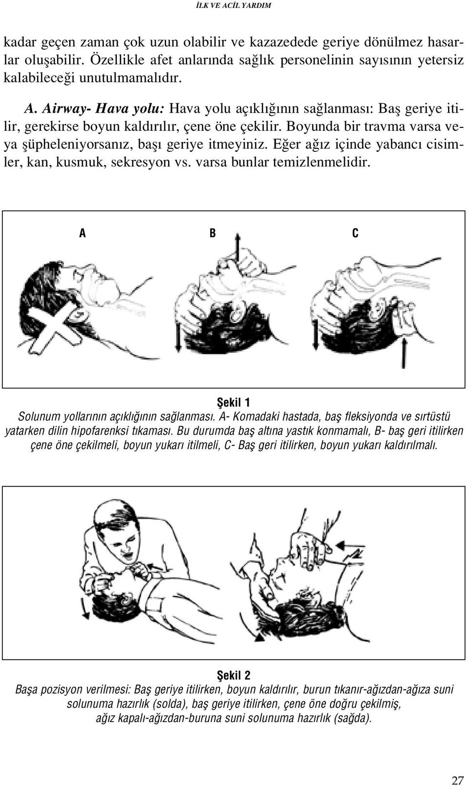 E er a z içinde yabanc cisimler, kan, kusmuk, sekresyon vs. varsa bunlar temizlenmelidir. A B C fiekil 1 Solunum yollar n n aç kl n n sa lanmas.