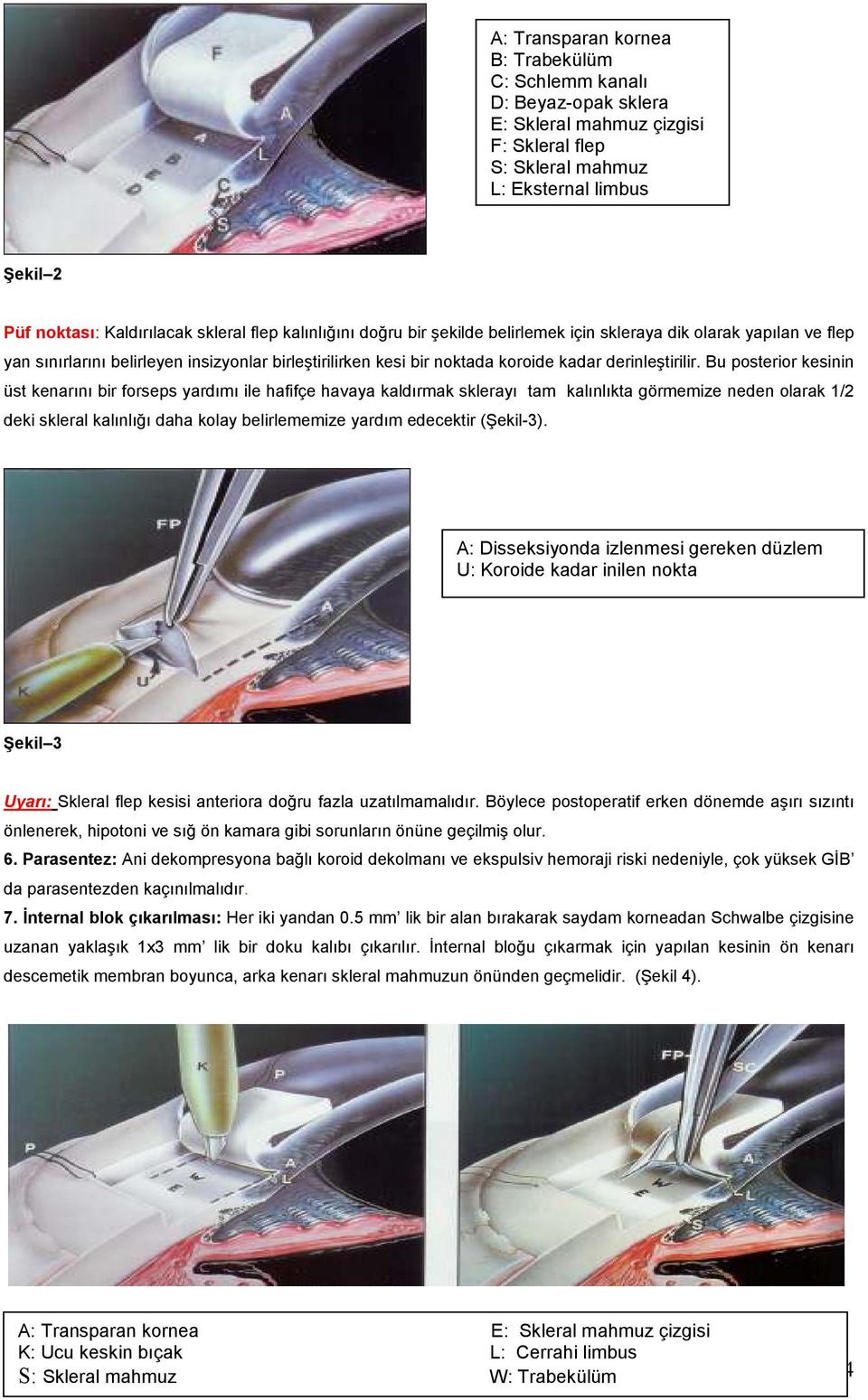 Bu posterior kesinin üst kenarını bir forseps yardımı ile hafifçe havaya kaldırmak sklerayı tam kalınlıkta görmemize neden olarak 1/2 deki skleral kalınlığı daha kolay belirlememize yardım edecektir