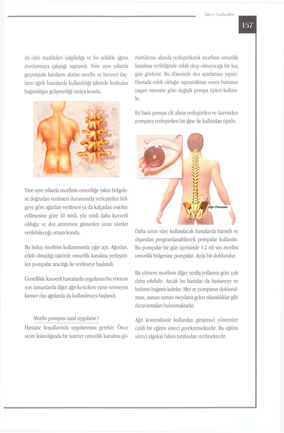 Yine aynı yıllarda morfinin omuriliğe yakın bölgelere doğrudan verilmesi durumunda yerleştirilen bölgeye göre ağızdan verilmesi ya da kalçadan enjekte edilmesine göre 10 misli, yüz misli daha