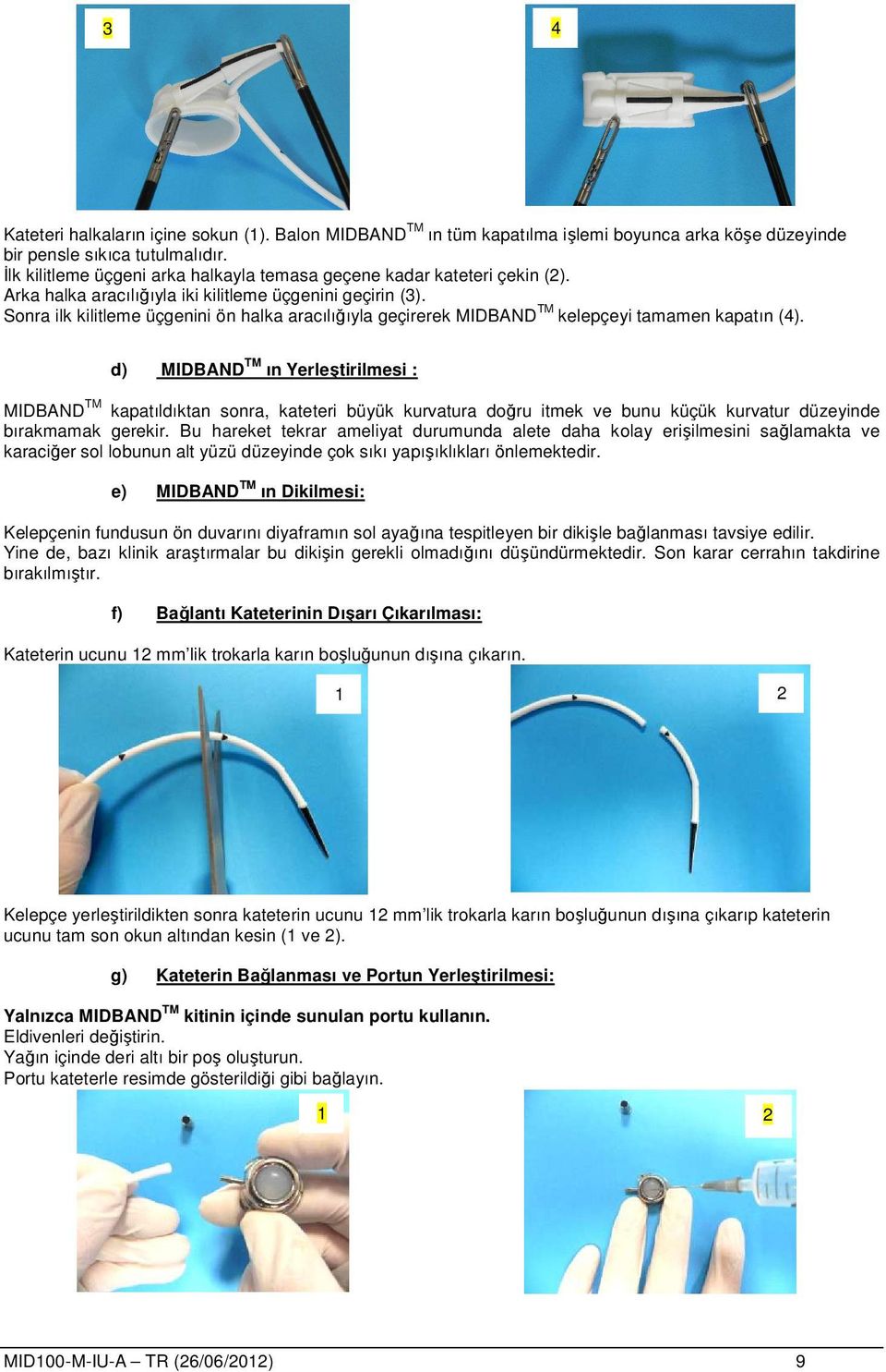 Sonra ilk kilitleme üçgenini ön halka aracılığıyla geçirerek MIDBAND TM kelepçeyi tamamen kapatın (4).