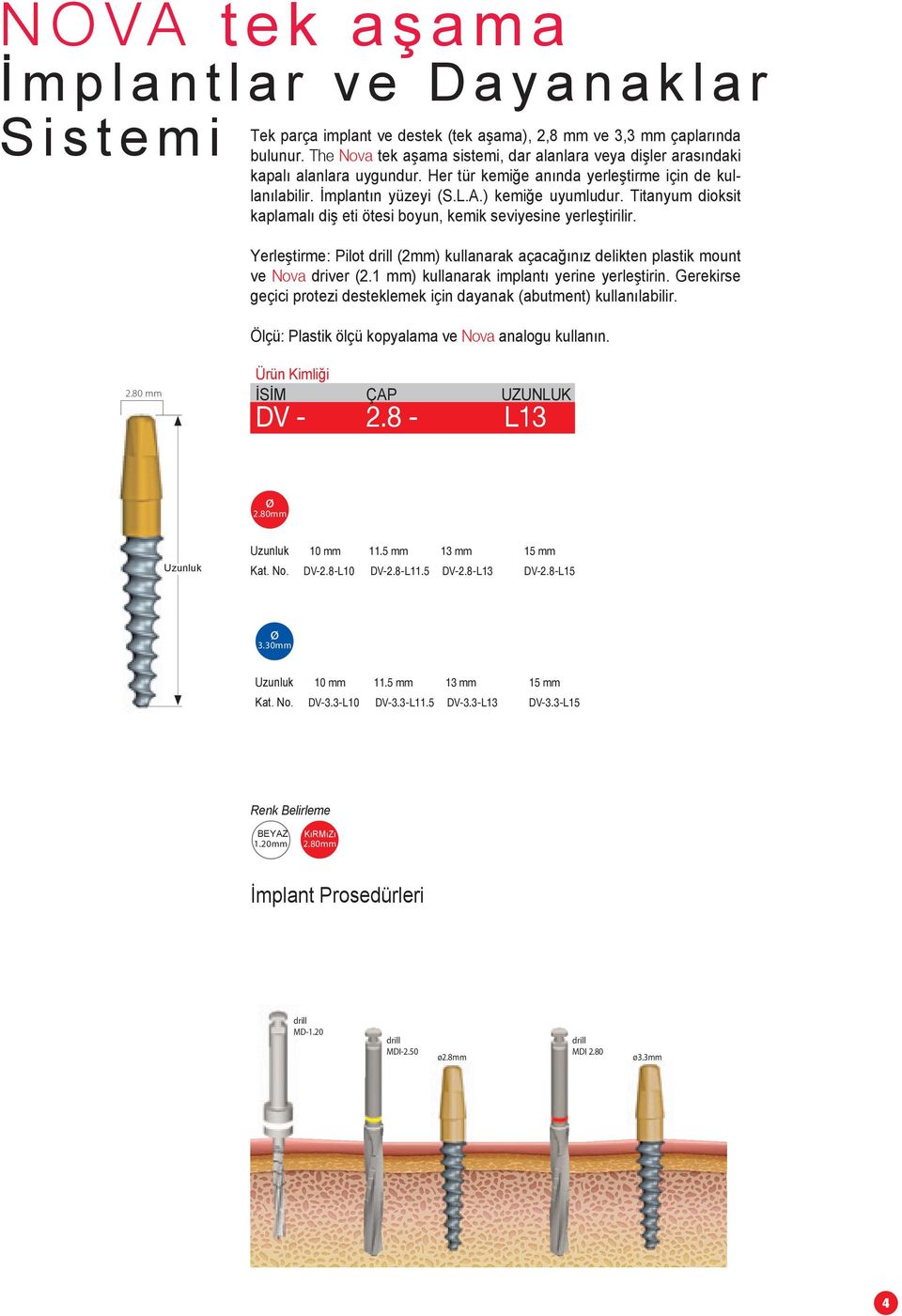 Titanyum dioksit kaplamalı diş eti ötesi boyun, kemik seviyesine yerleştirilir. Yerleştirme: Pilot drill (2mm) kullanarak açacağınız delikten plastik mount ve Nova driver (2.