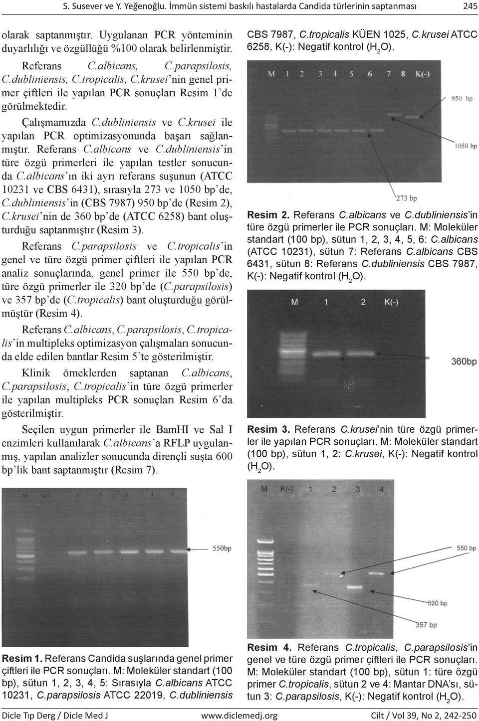 krusei ile yapılan PCR optimizasyonunda başarı sağlanmıştır. Referans C.albicans ve C.dubliniensis in türe özgü primerleri ile yapılan testler sonucunda C.