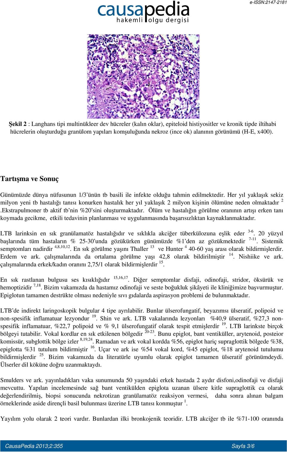 Her yıl yaklaşık sekiz milyon yeni tb hastalığı tanısı konurken hastalık her yıl yaklaşık 2 milyon kişinin ölümüne neden olmaktadır 2.Ekstrapulmoner tb aktif tb nin %20 sini oluşturmaktadır.