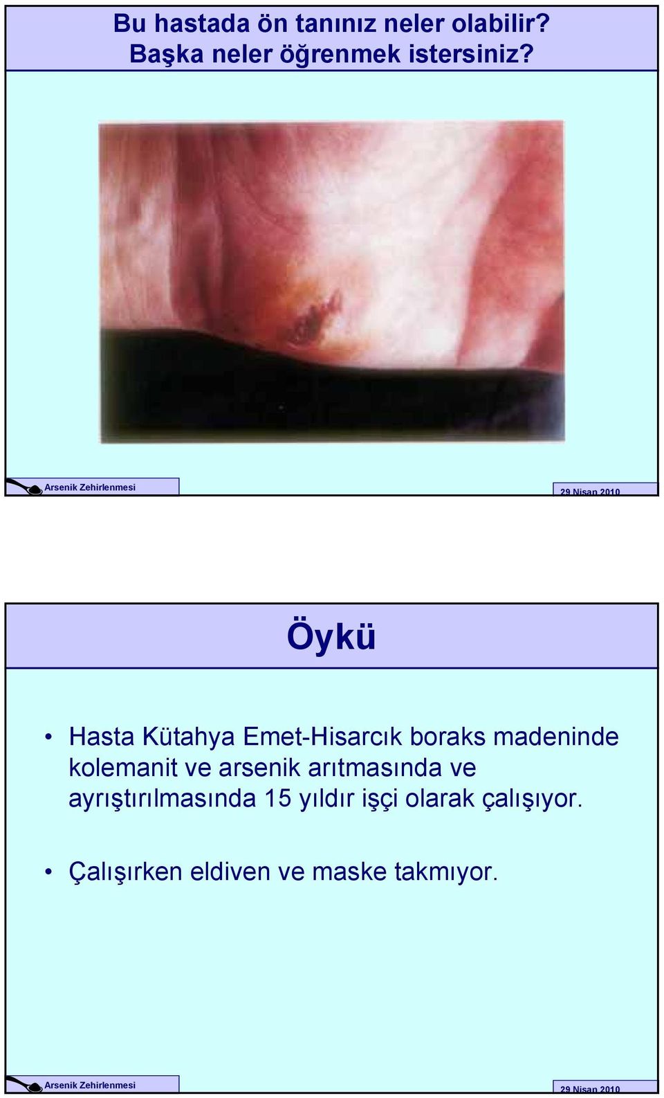 Öykü Hasta Kütahya Emet-Hisarcık boraks madeninde kolemanit