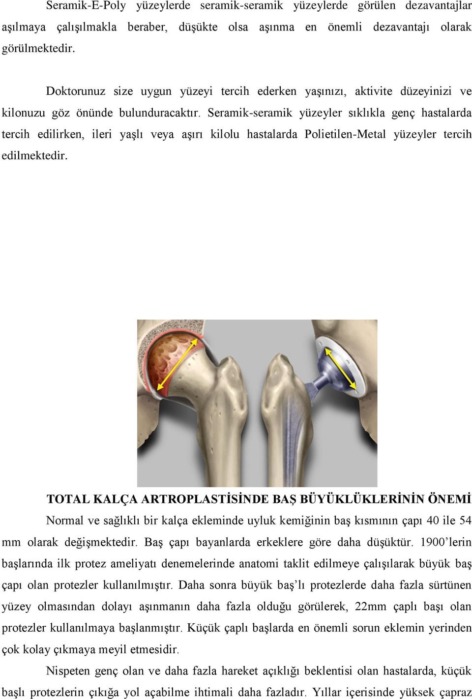 Seramik-seramik yüzeyler sıklıkla genç hastalarda tercih edilirken, ileri yaşlı veya aşırı kilolu hastalarda Polietilen-Metal yüzeyler tercih edilmektedir.