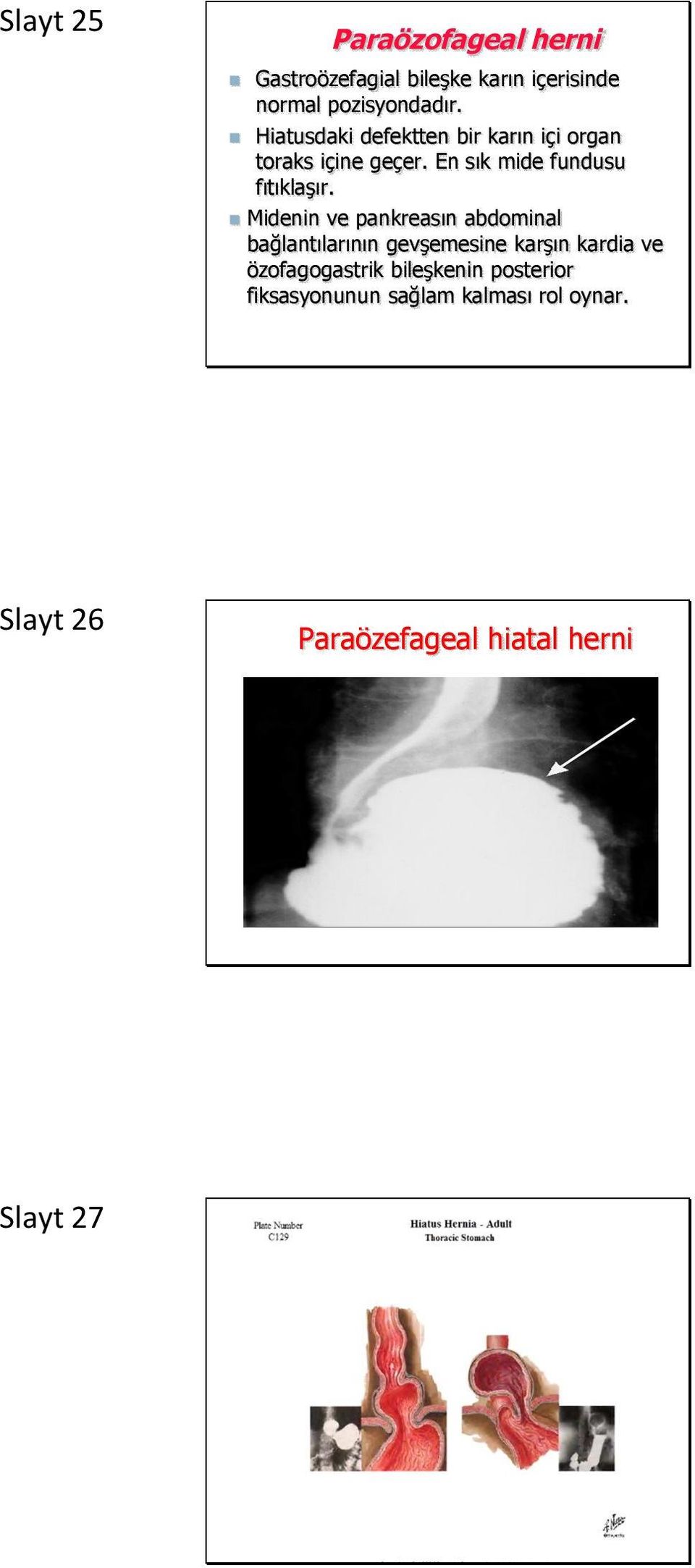 Midenin ve pankreasın abdominal bağlantılarının gevşemesine karşın kardia ve özofagogastrik